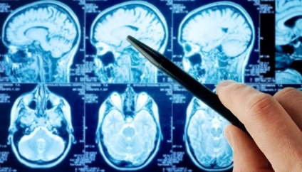 Neuroradiologie